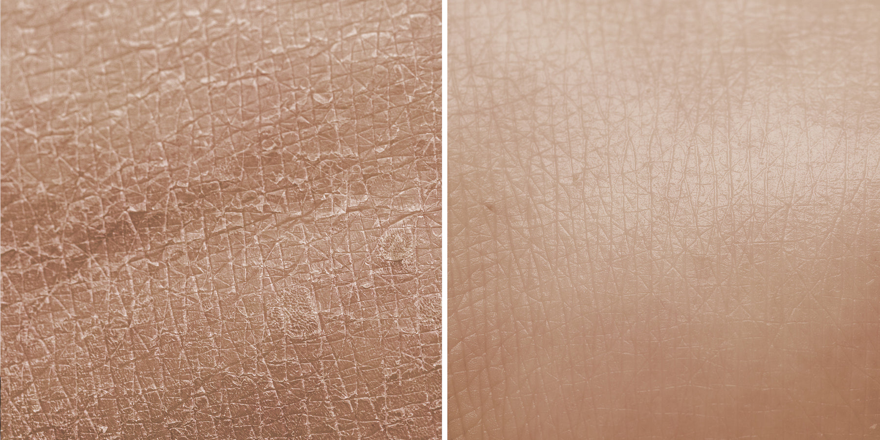 Dry Skin Vs Dehydrated Skin